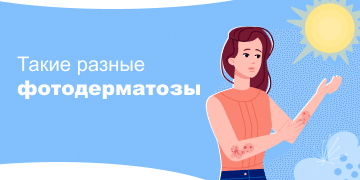 Превью статьи