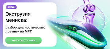 Превью статьи