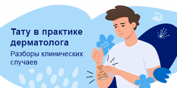 Превью статьи