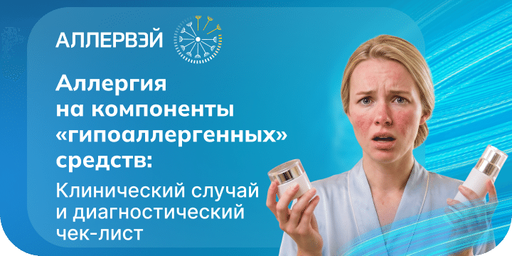 Превью статьи
