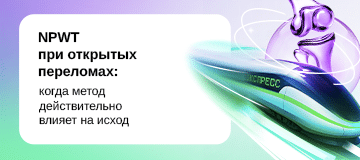 Превью статьи