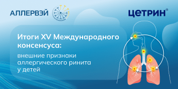 Превью статьи