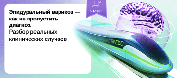 Превью статьи
