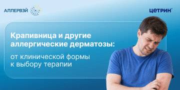 Превью статьи