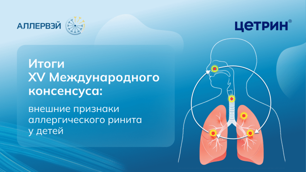 Превью содержания