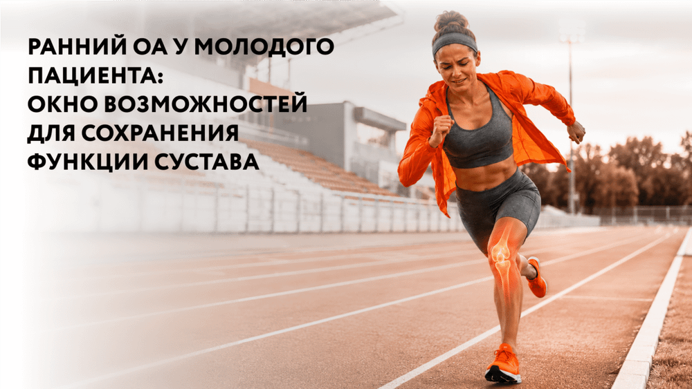Превью содержания