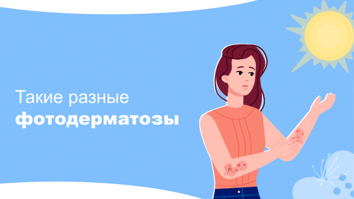 Превью содержания