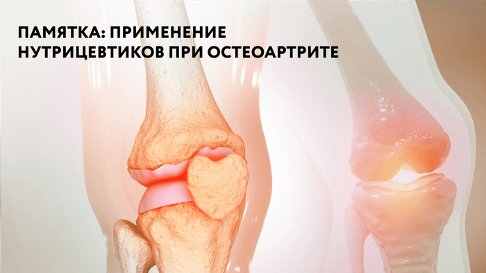 Превью содержания