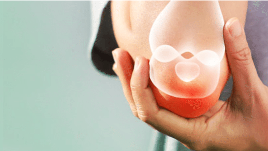 Превью содержания