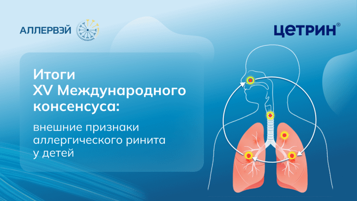 Превью содержания