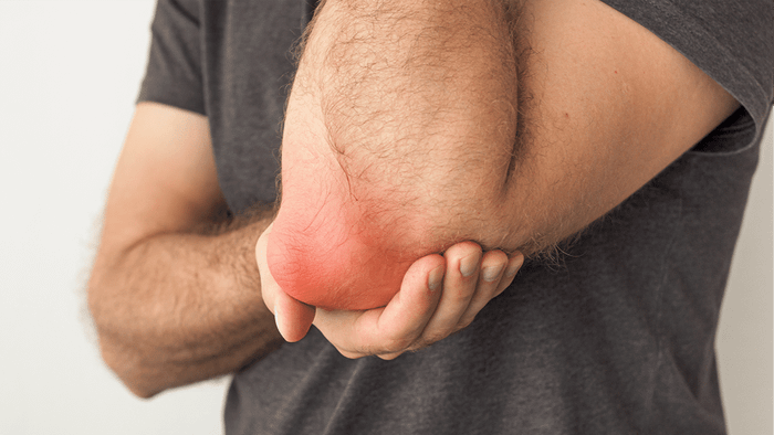 Превью содержания