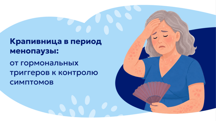 Превью содержания