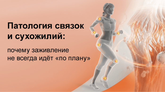 Превью содержания