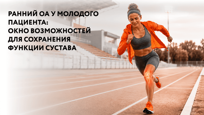 Превью содержания