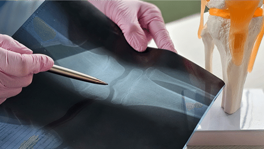 Превью содержания