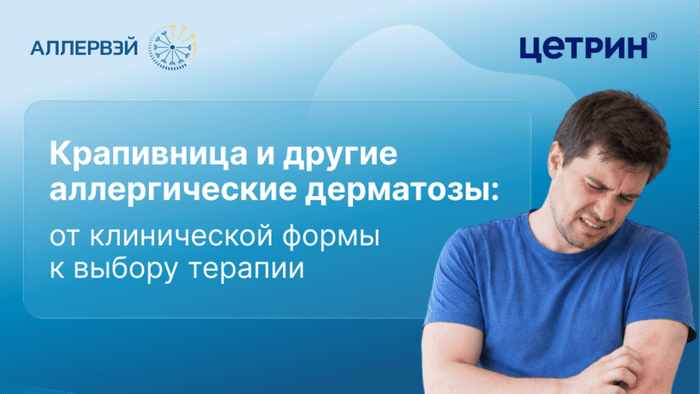 Превью содержания